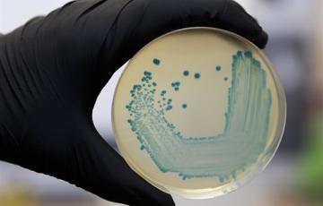 noticias cadiz cultivo listeriosis.jpg