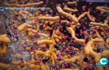 noticias cadizlisteriosis.jpg