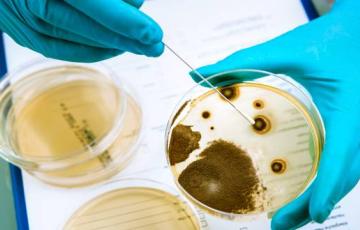 noticias cadiz Listeriosis.jpg