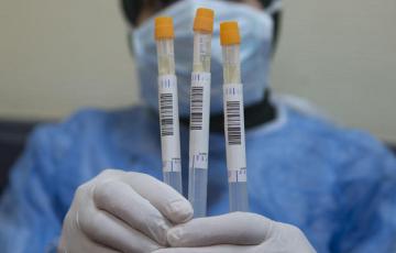 test-rapidos-coronavirus.jpg