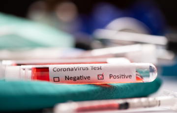 test coronavirus.png