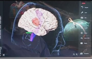 La Consejería de Salud activa campaña para la prevención y atención al ICTUS