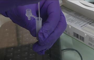 Sólo se harán test a casos graves y personas vulnerables