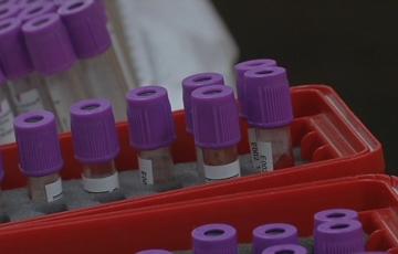 Los profesionales sanitarios alertan de la falta de reserva de sangre