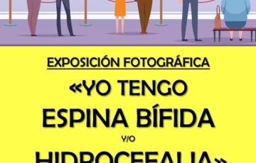 Los interesados podrán visitar la exposición del 2 al 24 de noviembre en la Casa de la Juventud.