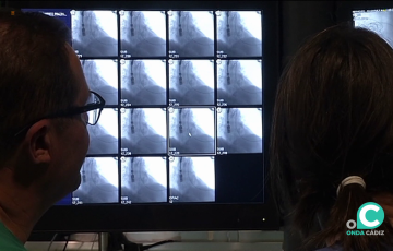 El riesgo de padecer cáncer de pulmón se cuadruplica con el consumo de cigarrillos