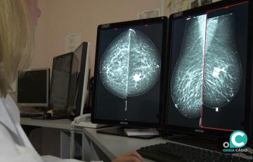 Una doctora revisa una prueba de cribado. 