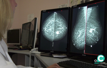 Estudio de una mamografía 