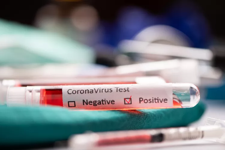 test coronavirus.png