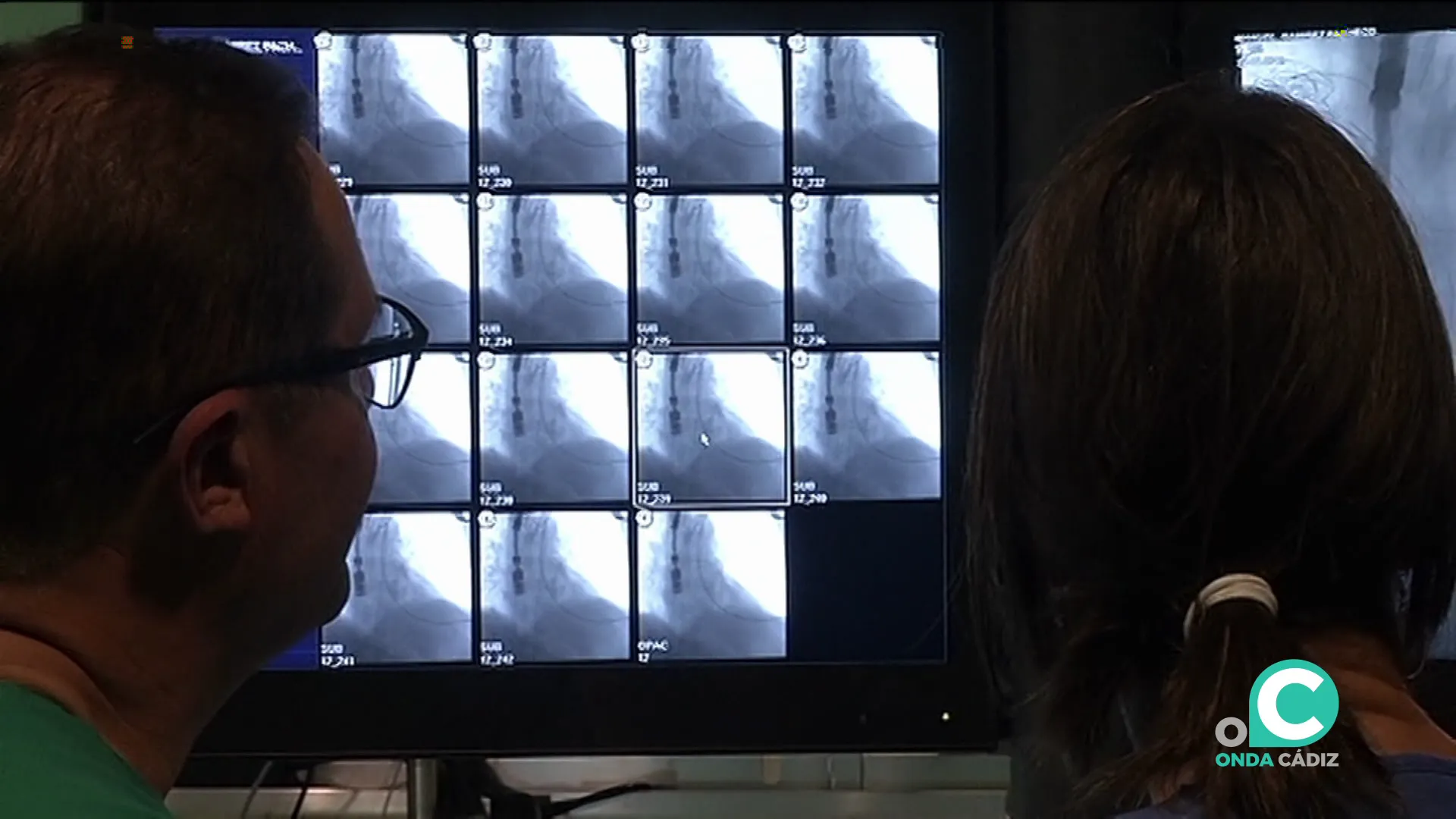 El riesgo de padecer cáncer de pulmón se cuadruplica con el consumo de cigarrillos