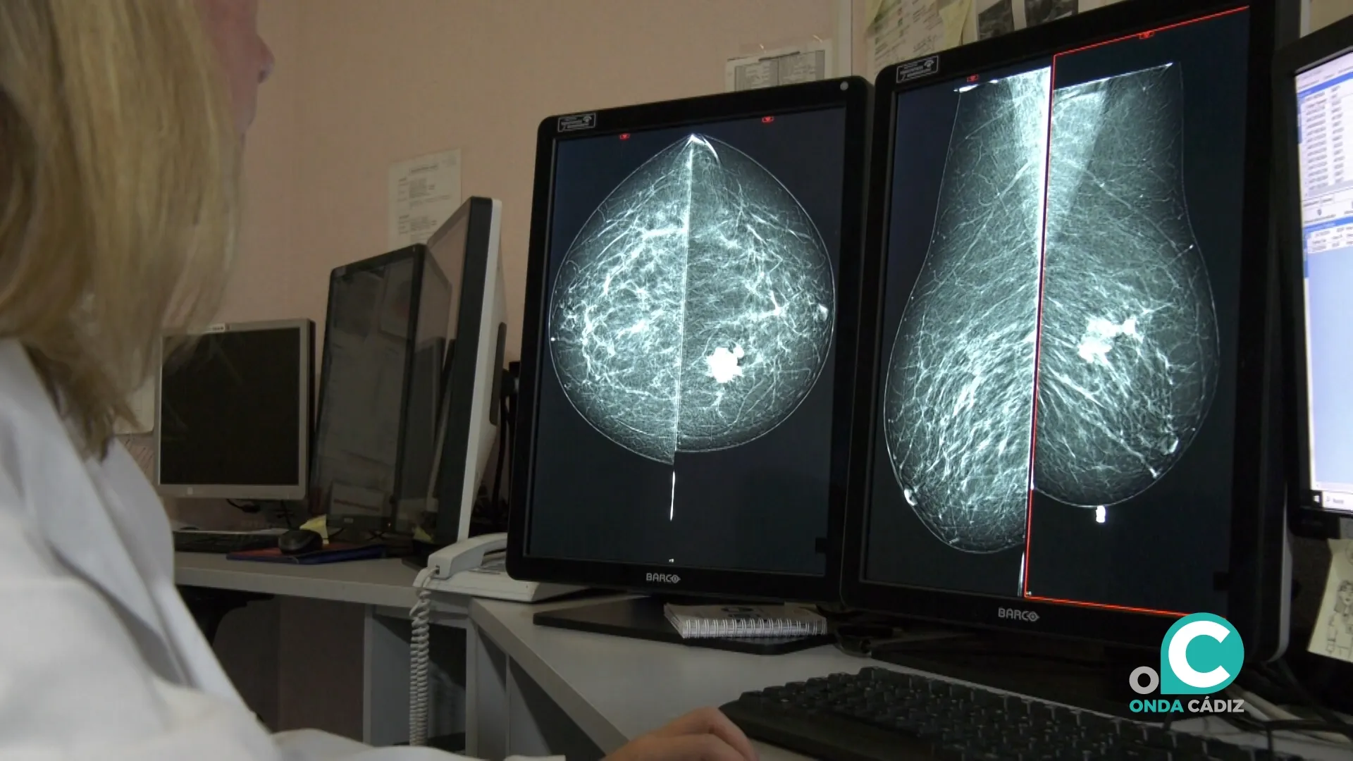 Una doctora revisa una prueba de cribado. 