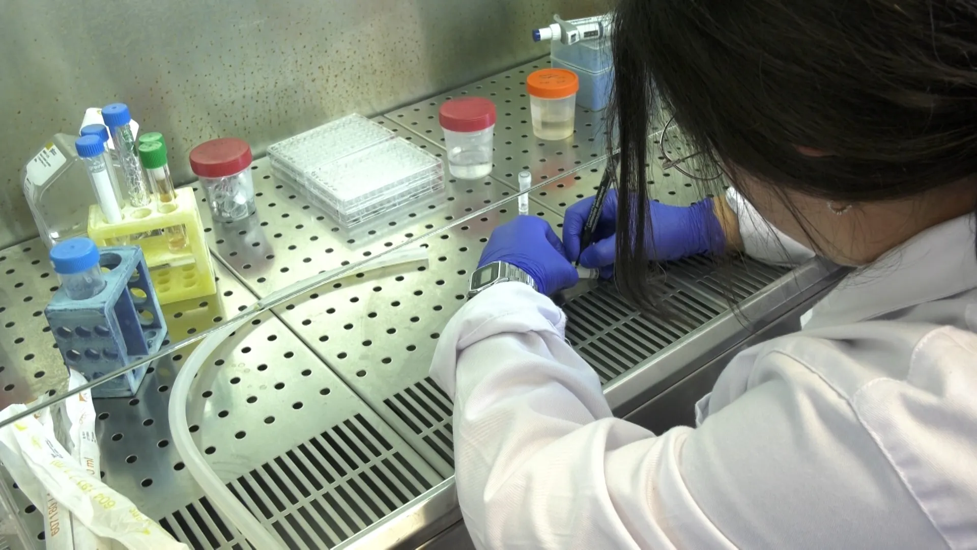 Un estudio andaluz indentifica un biomarcador en sangre para mejorar el diagnóstico del cáncer de ovario